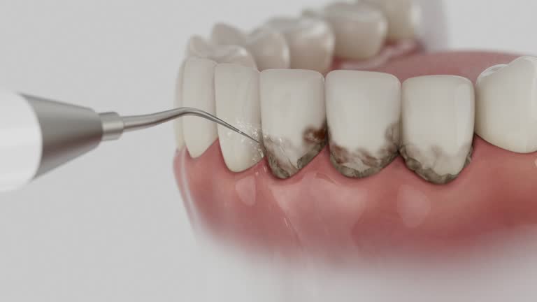 Trusted Dental Crowns And Bridges service in Gregory, TX - Dentist Open Now